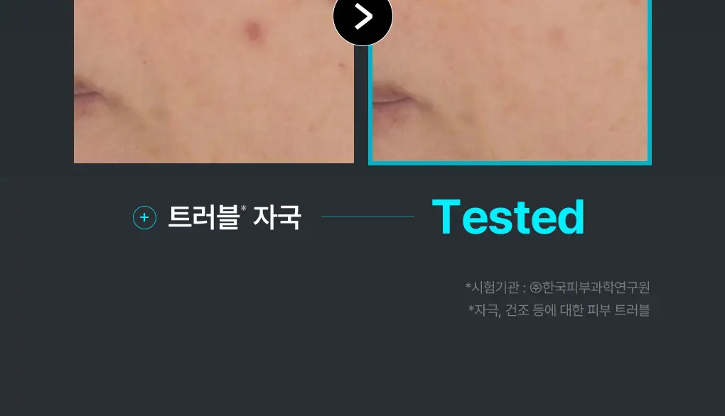 [76관왕 No.1] 메디힐 더마 패드 100매 7종 피부 고민별 골라담기 상세페이지 15